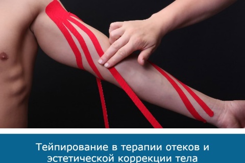 Тейпирование в терапии отеков и эстетической коррекции тела